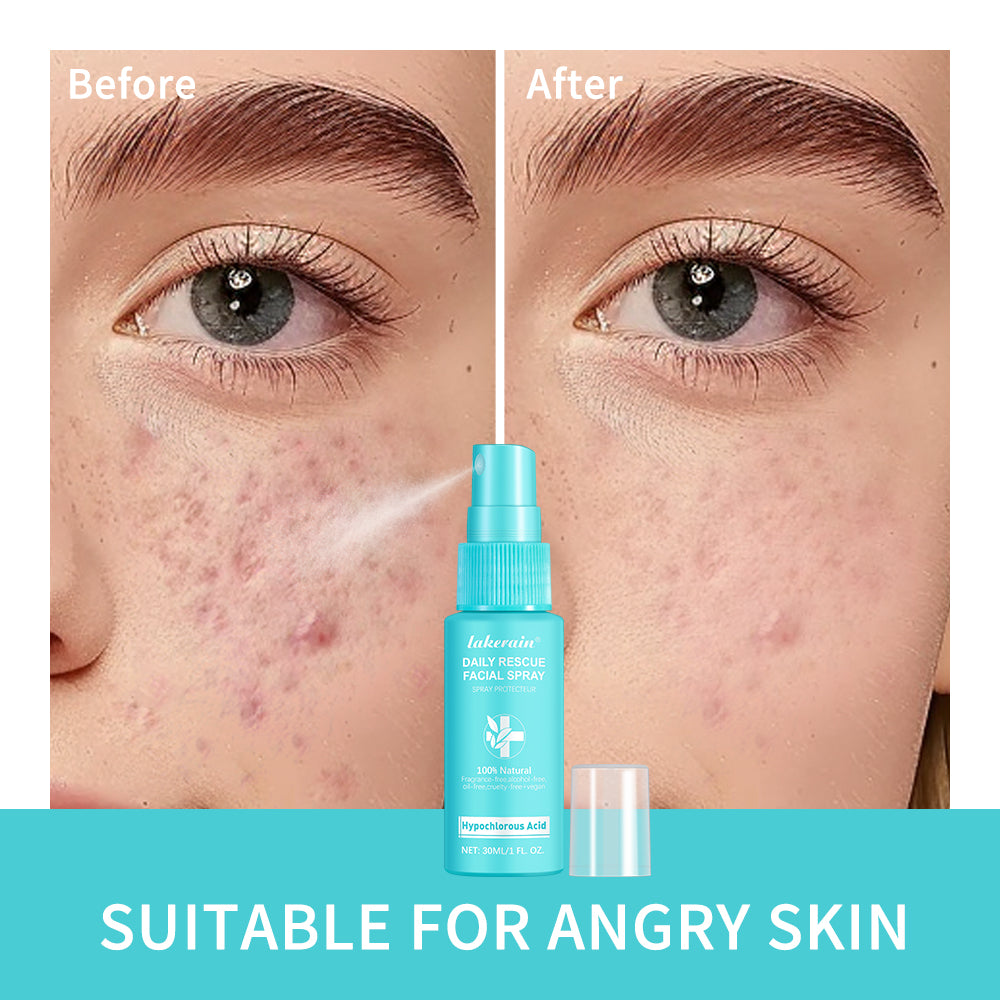 lakerain Daily Rescue Facial Spray – Hypochlorous Acid Soothing & Purifying Face Mist