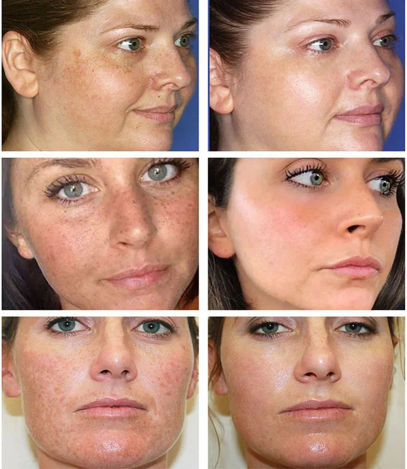 Hoygi Dark Spot Correction Cream – Lightening & Brightening Facial Cream