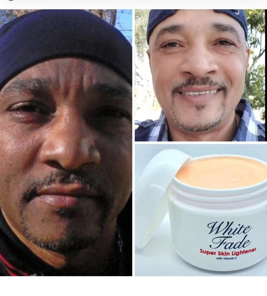 White Fade Super Skin Lightener – Dark Spot Correcting & Brightening Cream