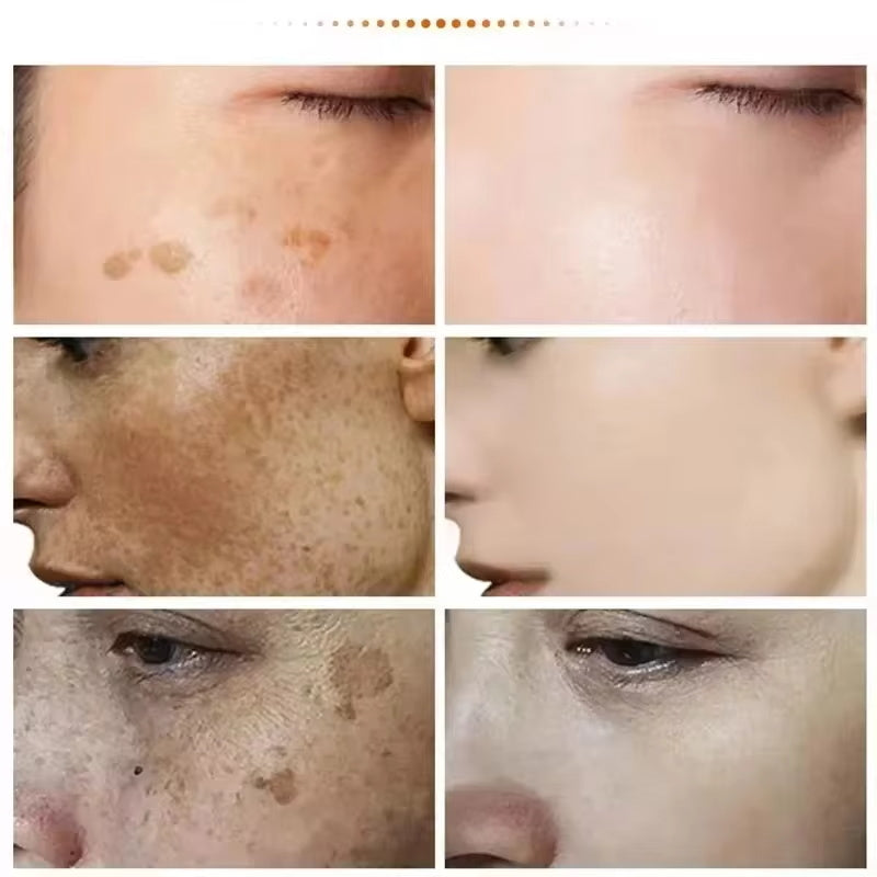 Hoygi Dark Spot Correction Cream – Lightening & Brightening Facial Cream