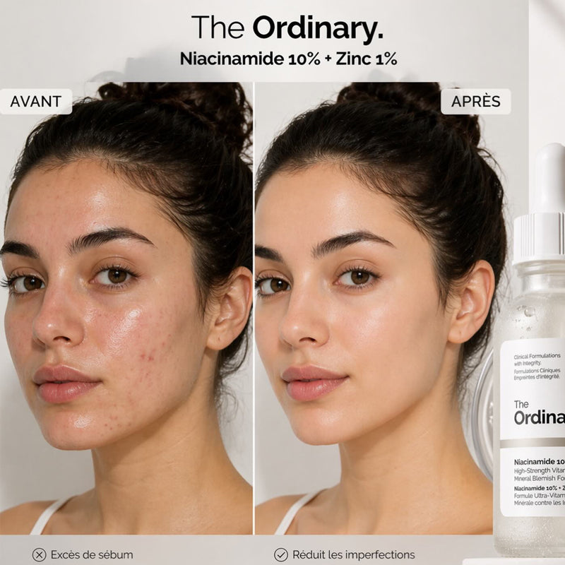 The Ordinary Niacinamide 10% + Zinc 1% – High-Strength Blemish & Pore Refining Serum