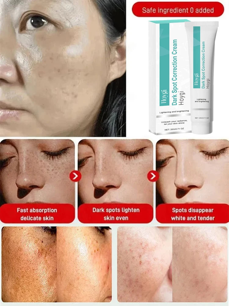 Hoygi Dark Spot Correction Cream – Lightening & Brightening Facial Cream