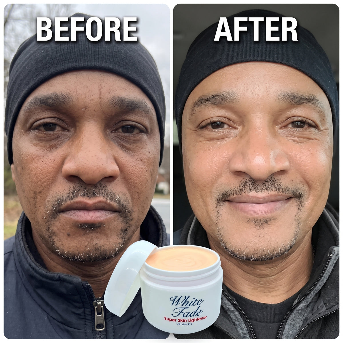 White Fade Super Skin Lightener – Dark Spot Correcting & Brightening Cream
