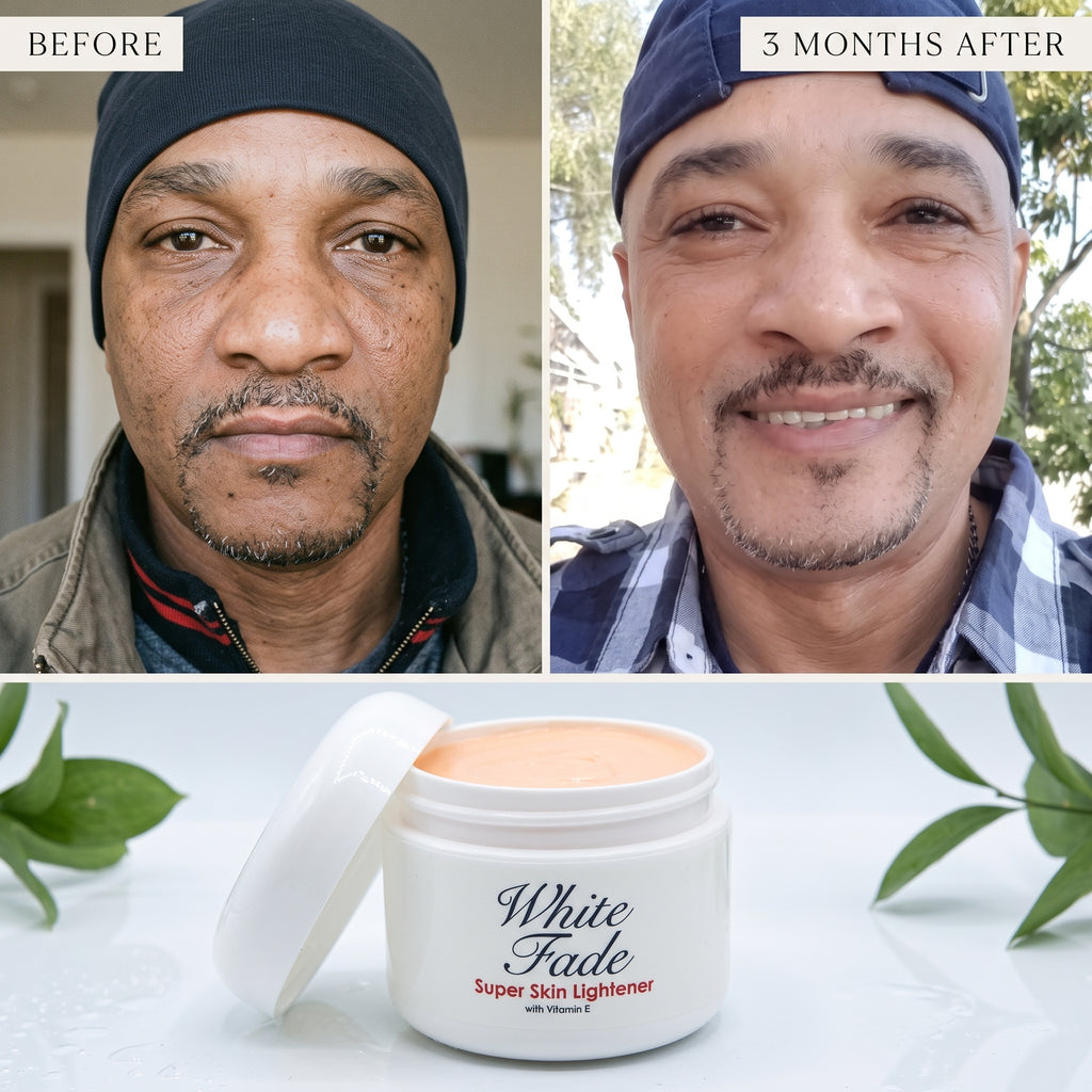 White Fade Super Skin Lightener – Dark Spot Correcting & Brightening Cream