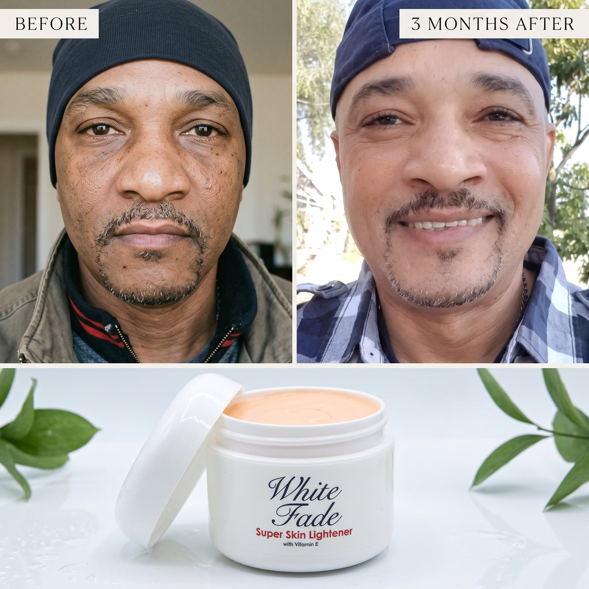 White Fade Super Skin Lightener – Dark Spot Correcting & Brightening Cream